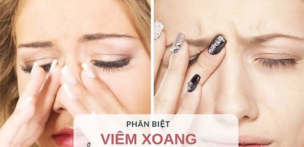 Phân biệt viêm xoang và viêm mũi dị ứng