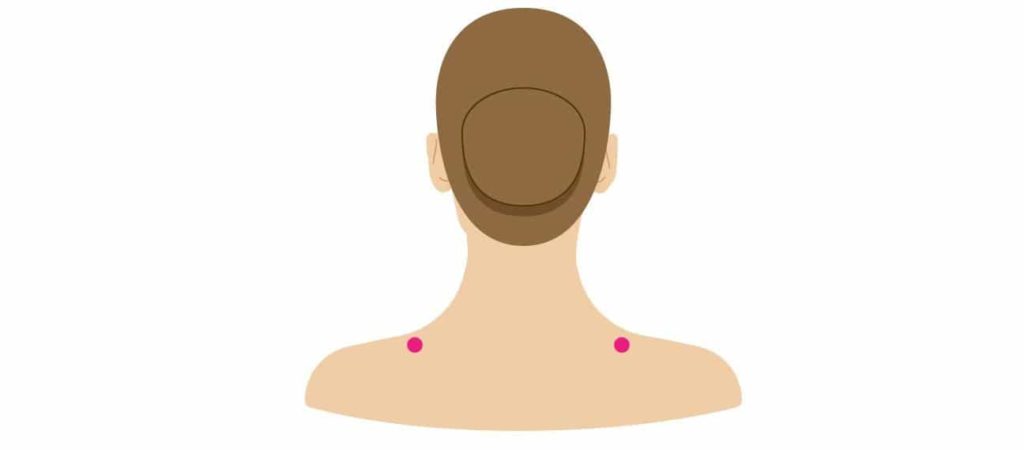 huyệt kiên tỉnh nằm ở mặt trên vai