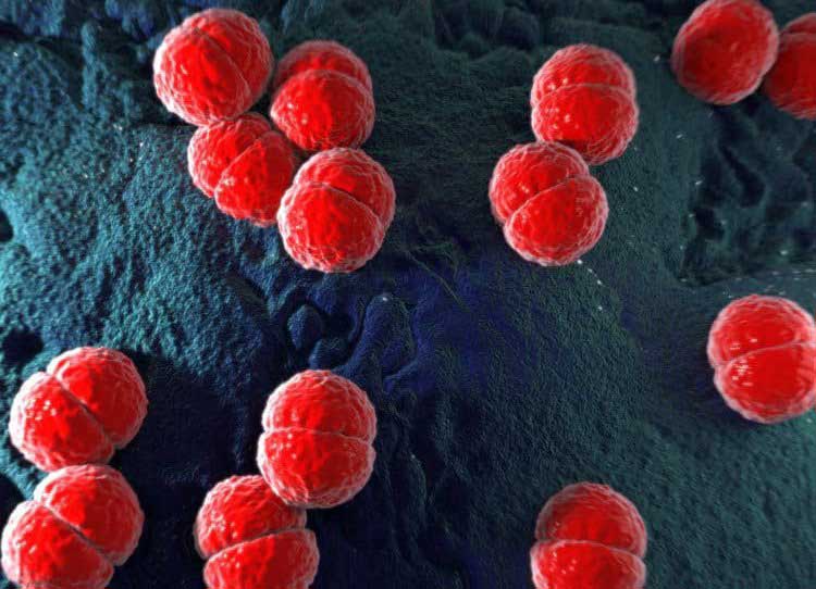 Sốt cao rét run đau đầu, mệt mỏi là triệu chứng của sốt virus