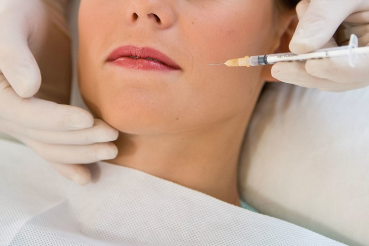 Biện pháp điều trị đau nhức quai hàm xâm lấn phổ biến nhất là tiêm botox