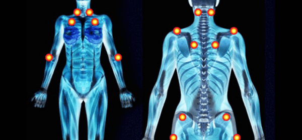Những khu vực trên cơ thể thường xảy ra các cơn đau