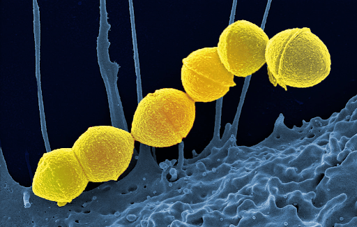 virus gây viêm amidan 