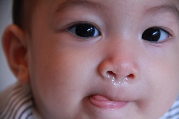 Trẻ bị viêm mũi dị ứng làm chảy nước mũi, hắt hơi