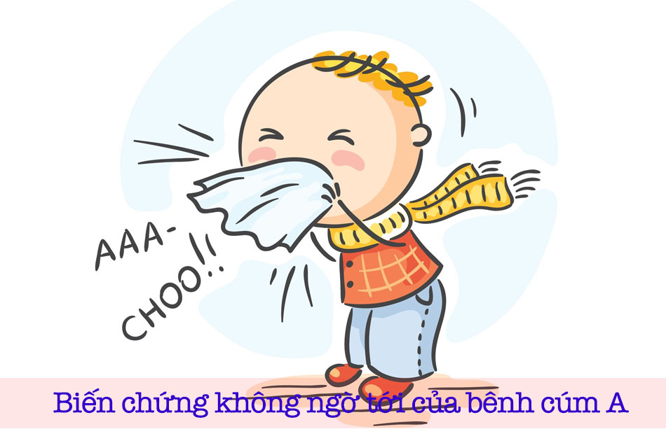 Dấu hiệu và biến chứng Cúm A