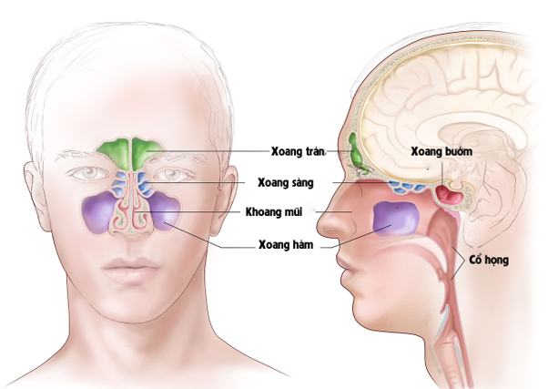 Viêm xoang mãn tính gồm những loại nào