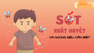 sot-xuat-huyet-o-tre-em-may-ngay-thi-khoi-2