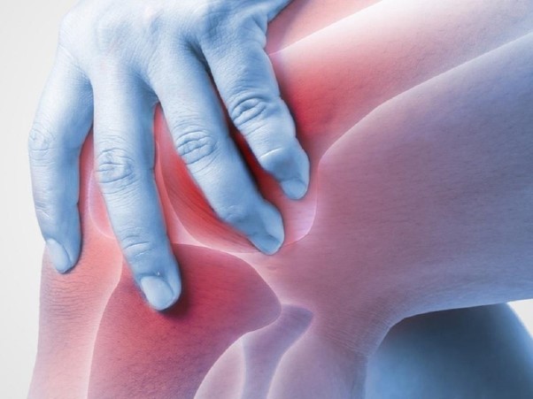 Viêm khớp là tình trạng thường thấy