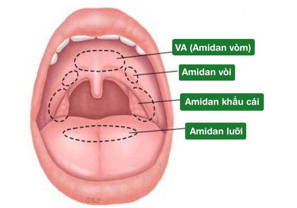 Phân biệt viêm amidan