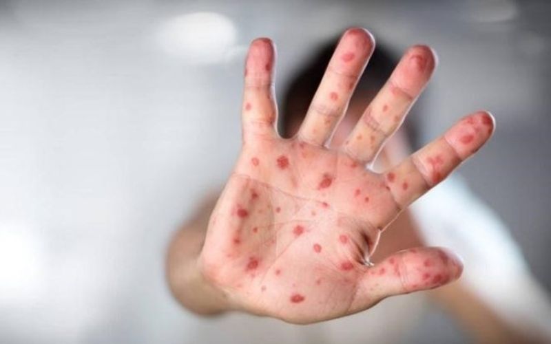 Lưu ý khi áp dụng mẹo dân gian chữa chân tay miệng