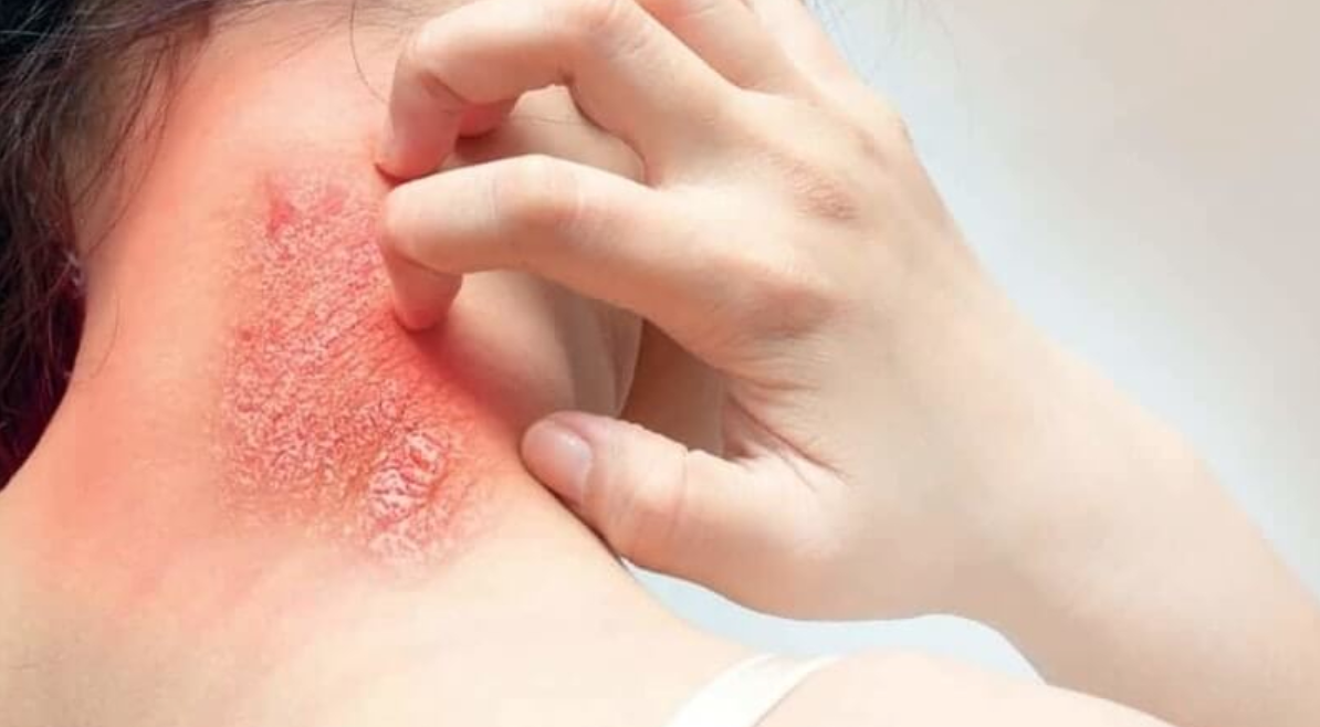 nhiễm khuẩn máu
