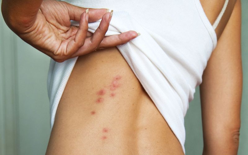 Cách phòng bệnh sốt xuất huyết ở người lớn