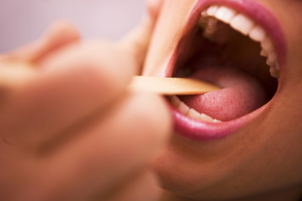 Viêm họng mãn tính có nguy hiểm không?