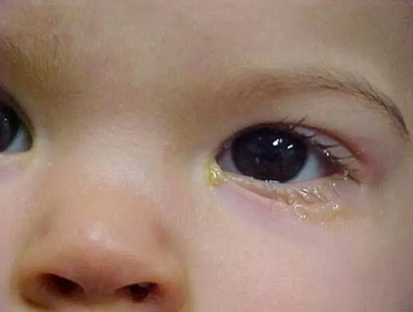Cha mẹ nên bình tĩnh để phát hiện và đưa con đi điều trị kịp thời