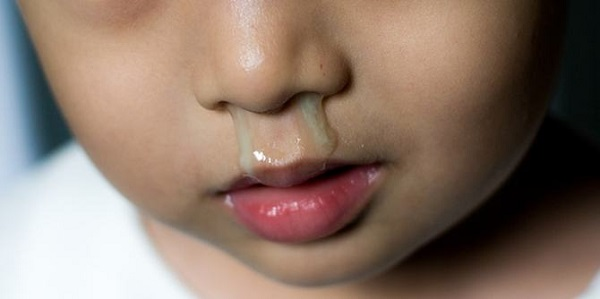 Thời tiết là một trong những nguyên nhân hàng đầu dẫn đến sổ mũi xanh ở bé