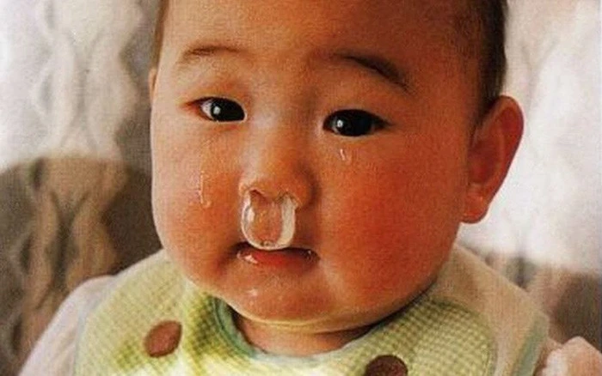 Trẻ bị sổ mũi xanh có  nguy hiểm không?
