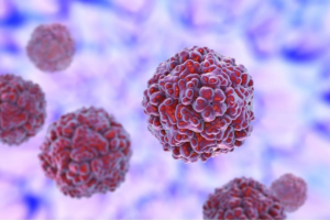 Virus Rhinovirus gây viêm phổi ở trẻ