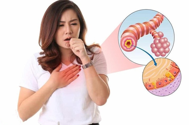 Họ là triệu chứng thường thấy của bệnh viêm phế quản co thắt